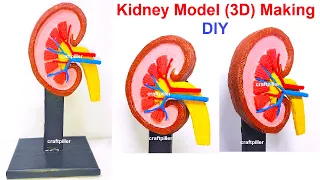 kidney model(3D) making science project - diy