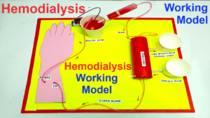 How To Make The Hemodialysis Working Model - Science Projects | Maths ...